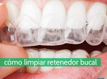 Cómo limpiar los retenedores bucales